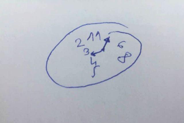 Ljudi koji ne mogu da nacrtaju sat treba da se jave lekaru